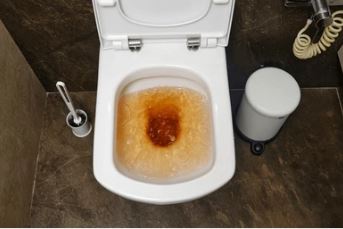 Nguyên nhân bồn cầu bị tắc thường gặp trong gia đình